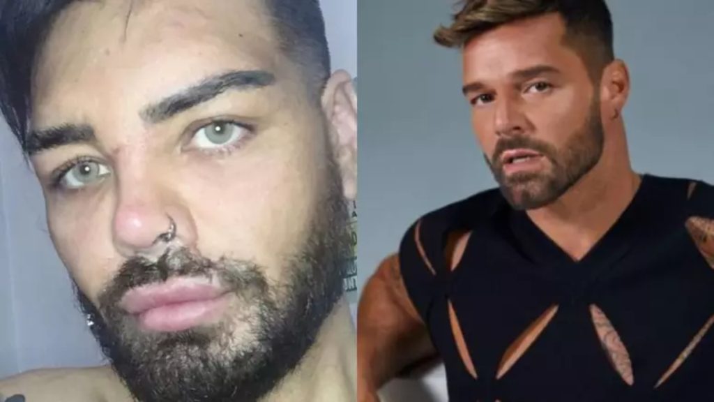 Fã argentino de Ricky Martin faz mais de 30 cirurgias plásticas para ficar parecido com o artista. Foto: Reprodução/Instagram