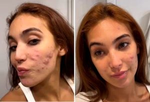 Antes e depois de Vanessa Lopes - Reprodução/Instagram