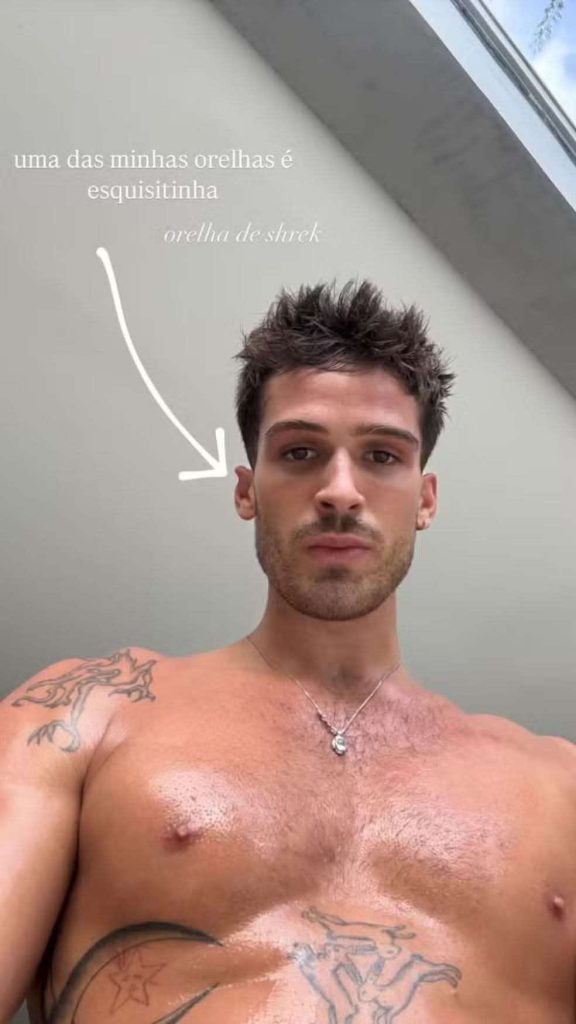 Ator João Guilherme posta foto sem camisa e orelha chama atenção 